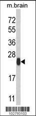 Anti-ATG12 Rabbit Polyclonal Antibody