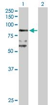 Anti-BBS7 Rabbit Polyclonal Antibody