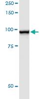 Anti-STAT5A Polyclonal Antibody Pair