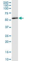 Anti-IFIT2 Polyclonal Antibody Pair