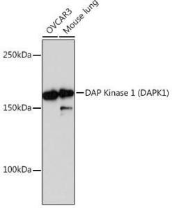 Anti-DAP Kinase 1 Rabbit Monoclonal Antibody [clone: ARC0601]