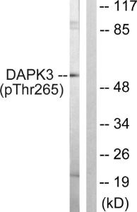 Western blot analysis of lysates from HUVEC cells using Anti-DAPK3 (phospho Thr265) Antibody. The right hand lane represents a negative control, where the Antibody is blocked by the immunising peptide