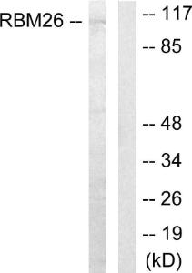 Western blot analysis of lysates from Jurkat cells using Anti-RBM26 Antibody The right hand lane represents a negative control, where the antibody is blocked by the immunising peptide