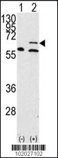 Anti-MMP14 Rabbit Polyclonal Antibody