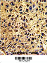 Anti-NUP62 Rabbit Polyclonal Antibody