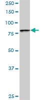 Anti-BBS7 Rabbit Polyclonal Antibody