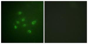 Immunofluorescence analysis of A549 cells using Anti-DAPK3 (phospho Thr265) Antibody. The right hand panel represents a negative control, where the Antibody was pre-incubated with the immunising peptide