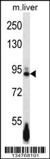 Anti-EPHB4 Rabbit Polyclonal Antibody