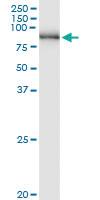 Anti-PNPT1 Rabbit Polyclonal Antibody