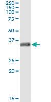 Anti-GSC Antibody Pair