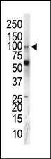 Anti-EPHA5 Rabbit Polyclonal Antibody (PE (Phycoerythrin))