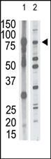 Anti-MMP15 Rabbit Polyclonal Antibody