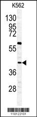 Anti-GHRHR Rabbit Polyclonal Antibody