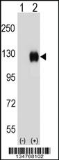 Anti-EPHB4 Rabbit Polyclonal Antibody