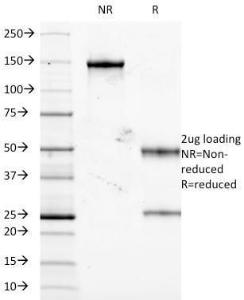 SDS-PAGE analysis of Anti-TNF alpha Antibody [J2D10] under non-reduced and reduced conditions; showing intact IgG and intact heavy and light chains, respectively. SDS-PAGE analysis confirms the integrity and purity of the antibody.