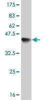 Anti-ERN1 Mouse Monoclonal Antibody [clone: 4E1]