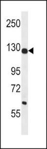 Anti-PC Rabbit Polyclonal Antibody (FITC (Fluorescein Isothiocyanate))