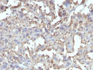 Anti-TNF alpha antibody