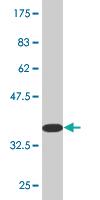 Anti-RGS5 Mouse Monoclonal Antibody [clone: 4E12]