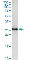 Anti-TSSK3 Polyclonal Antibody Pair