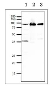 Anti-RRM1 Antibody