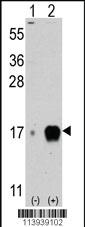 Anti-MAMSTR Rabbit Polyclonal Antibody