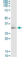 Anti-LGALS8 Mouse Monoclonal Antibody [clone: 3E5]