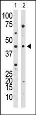 Anti-YY1 Rabbit Polyclonal Antibody (AP (Alkaline Phosphatase))