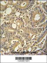 Anti-TPSD1 Rabbit Polyclonal Antibody (PE (Phycoerythrin))