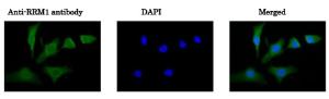 Anti-RRM1 Antibody