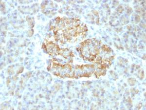 Anti-TNF alpha antibody