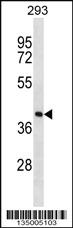 Anti-FDPS Rabbit Polyclonal Antibody