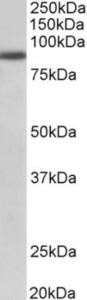 EB11208 (1 µg/ml) staining of A549 lysate (35 µg protein in RIPA buffer). Primary incubation was 1 hour. Detected by chemiluminescence.