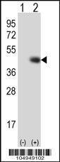 Anti-TPST1 Rabbit Polyclonal Antibody