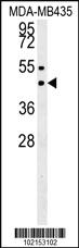 Anti-SUV39H1 Rabbit Polyclonal Antibody