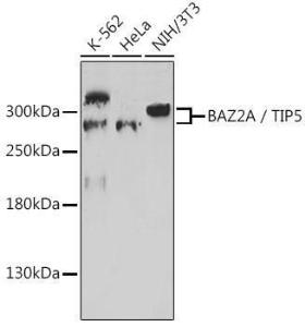 Western blot analysis of extracts of various cell lines, using Anti-BAZ2A / TIP5 Antibody (A308401) at 1:1,000 dilution. The secondary antibody was Goat Anti-Rabbit IgG H&L Antibody (HRP) at 1:10,000 dilution.