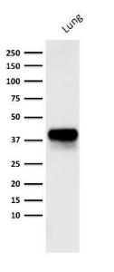 Western blot analysis of human lung lysate using Anti-EpCAM Antibody [PAN-EpCAM]