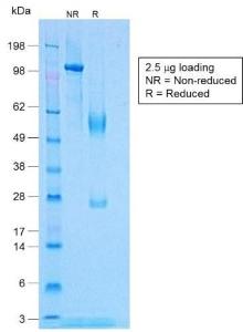 Anti-TNF alpha antibody