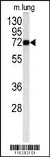 Anti-MAOB Rabbit Polyclonal Antibody