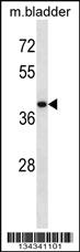 Anti-USP12 Rabbit Polyclonal Antibody