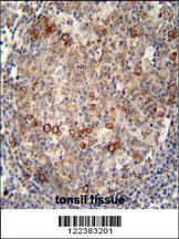 Anti-ABCC10 Rabbit Polyclonal Antibody (HRP (Horseradish Peroxidase))