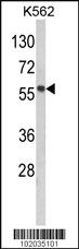 Anti-MMP19 Rabbit Polyclonal Antibody