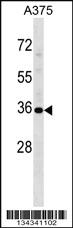 Anti-USP12 Rabbit Polyclonal Antibody