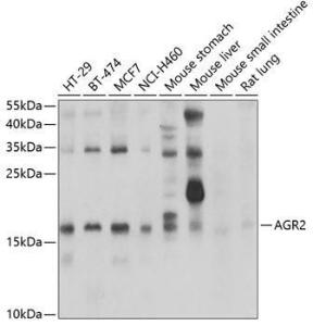 Western blot analysis of extracts of various cell lines, using Anti-AGR2 Antibody (A10053) at 1:1,000 dilution