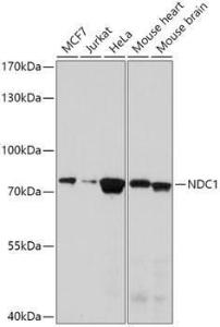 Western blot analysis of extracts of various cell lines, using Anti-NDC1 Antibody (A308402) at 1:1,000 dilution. The secondary antibody was Goat Anti-Rabbit IgG H&L Antibody (HRP) at 1:10,000 dilution.