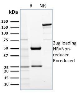 SDS-PAGE analysis of Anti-AKT1 Antibody [AKT1/2552] under non-reduced and reduced conditions; showing intact IgG and intact heavy and light chains, respectively. SDS-PAGE analysis confirms the integrity and purity of the antibody.