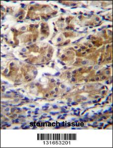 Anti-PDPR Rabbit Polyclonal Antibody (AP (Alkaline Phosphatase))