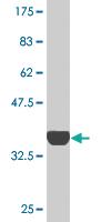 Anti-RNF13 Mouse Monoclonal Antibody [clone: 3E4]