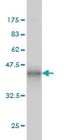 Anti-ERN1 Mouse Monoclonal Antibody [clone: 5F3]