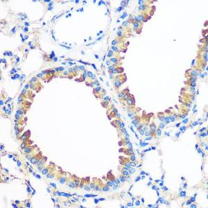 Immunohistochemistry analysis of paraffin-embedded mouse lung using Anti-AGR2 Antibody (A10053) at a dilution of 1:100 (40X lens). Perform microwave antigen retrieval with 10 mM PBS buffer pH 7.2 before commencing with IHC staining protocol